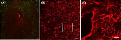 Dexamethasone-Enhanced Microdialysis and Penetration Injury